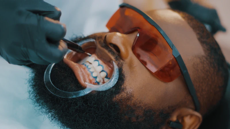 A dentist cleaning a man's teeth while he wears tinted safety glasses