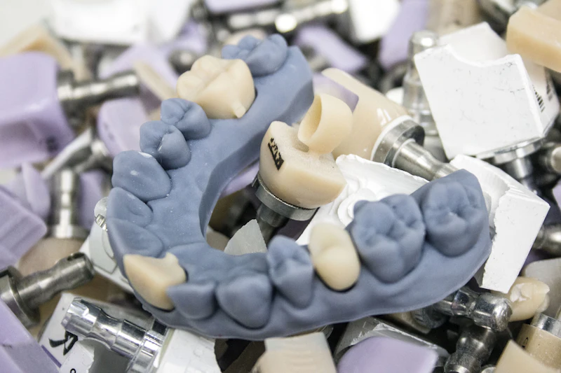 A model of teeth with implant posts and replacement teeth