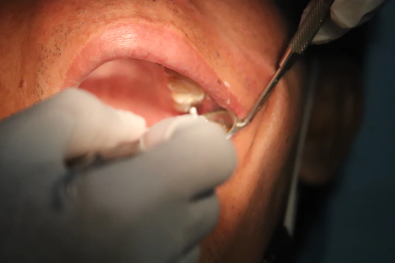 Close-up of a dentist's gloved hands working inside a patient's open mouth